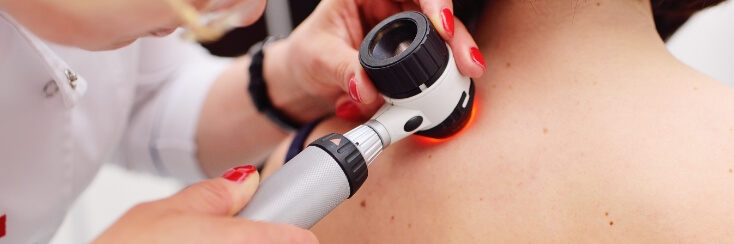 skin-check-imagepost