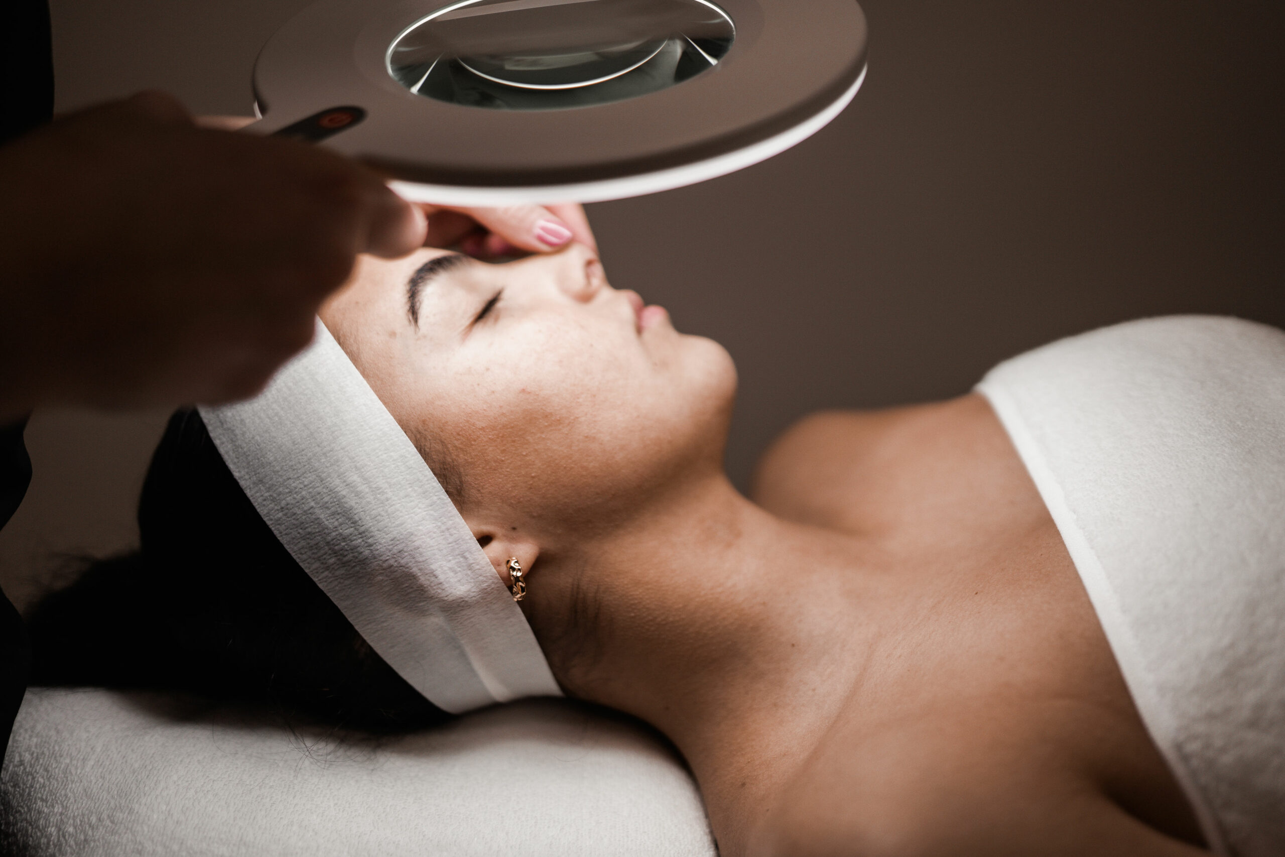 Advanced hyperpigmentation treatment at Shellharbour Skin with daily SPF and expert consultation