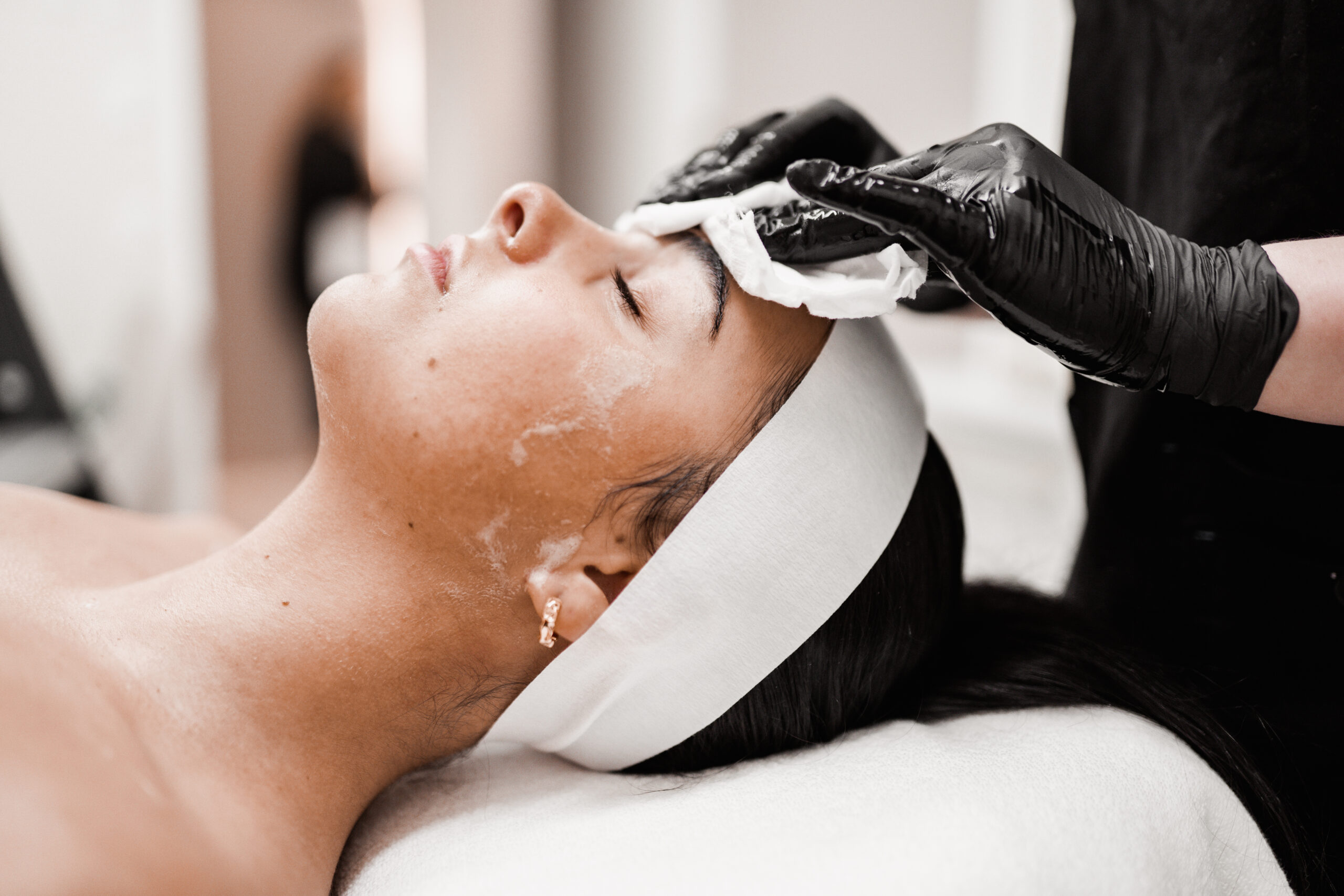 Patient undergoing a skin assessment at Shellharbour Skin for personalised acne treatment